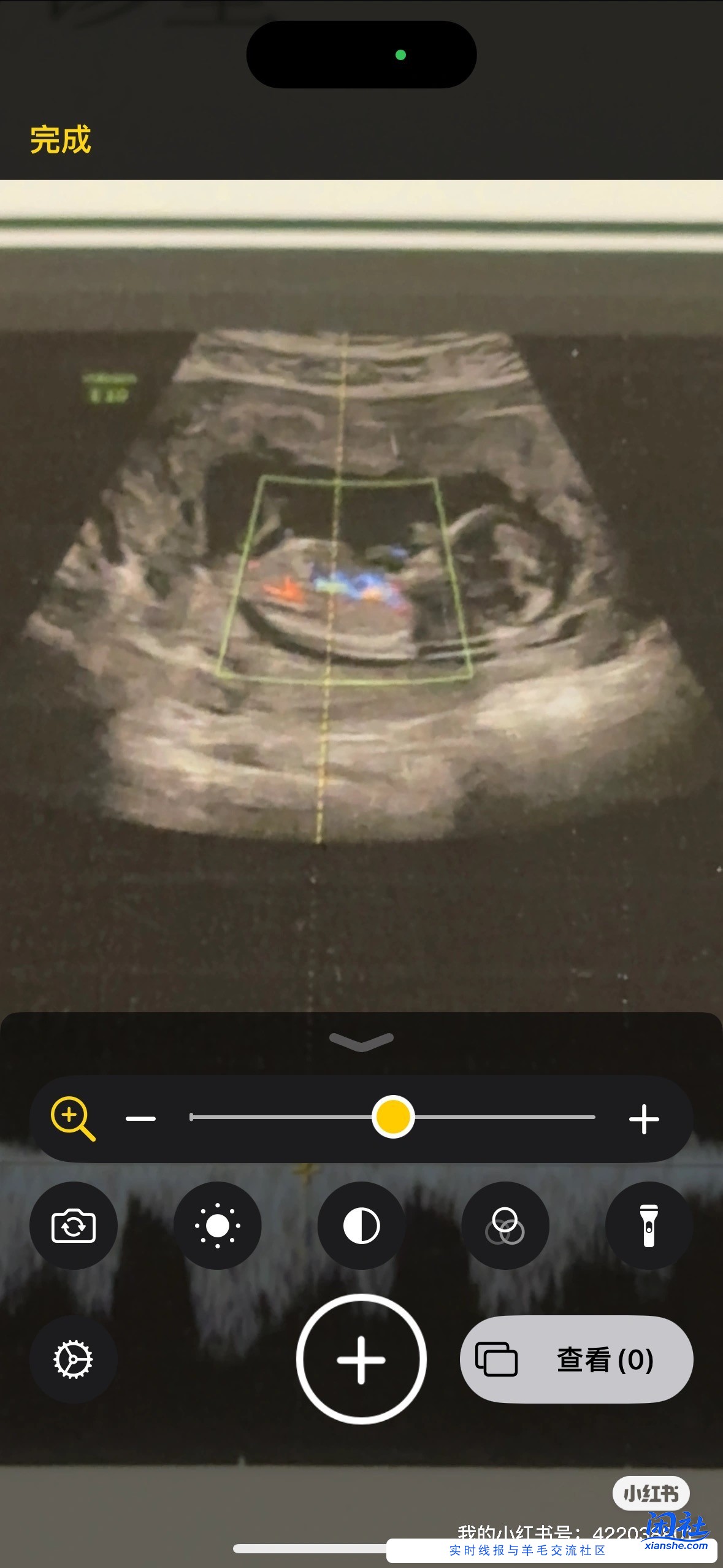 孕12周NT 能看出是蓝宝还是粉宝吗