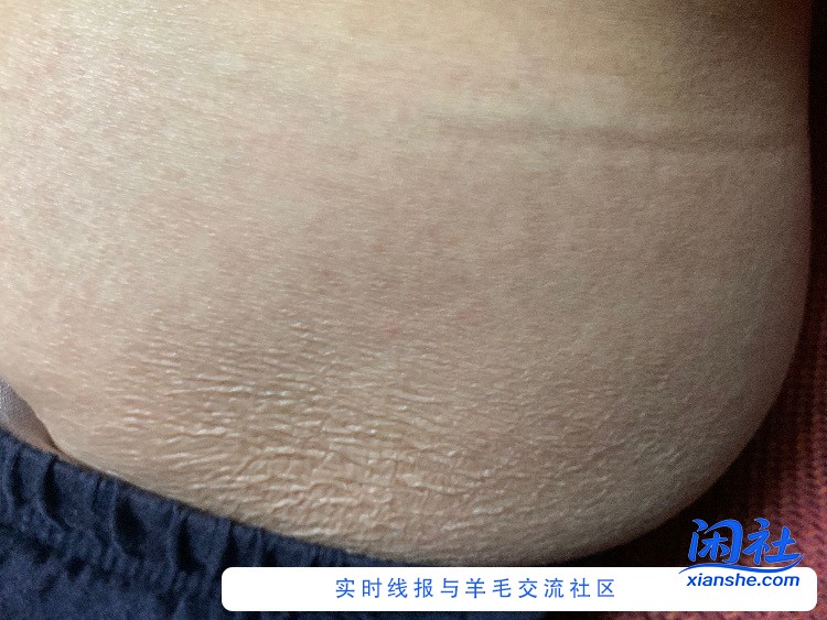 这大腿上肉皱巴巴的..吃出来的吗