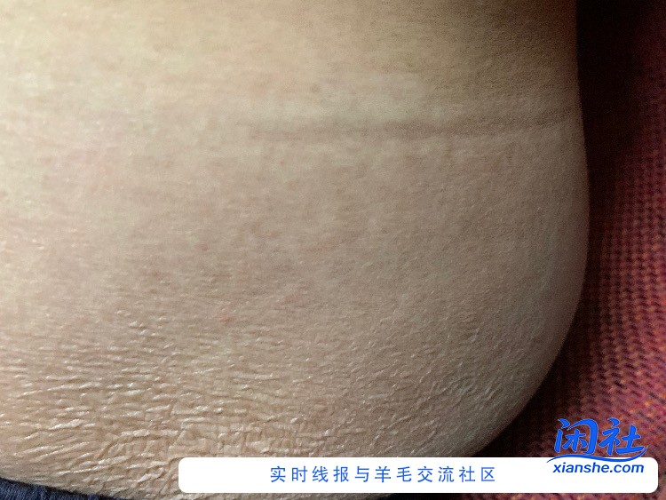 这大腿上肉皱巴巴的..吃出来的吗