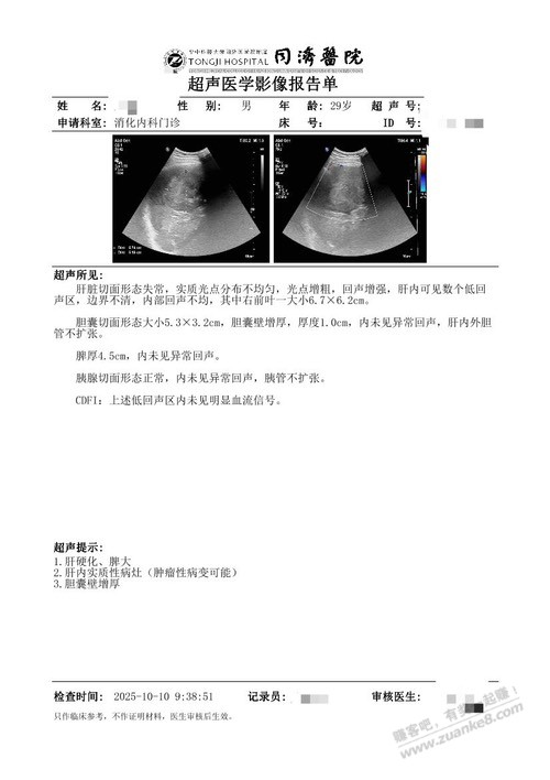 兄弟们  可能提前说拜拜啦
